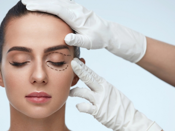 blefaroplastika 1 590x442